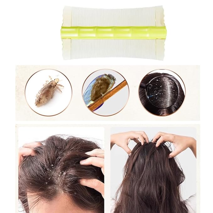 6 Pack Flea Lice Combs Double Sided Fine Tooth Pet Tear Stain Remover Combs Flea Combs Flea Removal Tool Pet Grooming Tool for Dog Cat Loose Fur Undercoat Dander Kitten Rabbit Guinea Pig Ferret